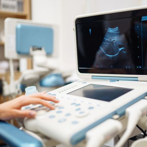 Ultrasound