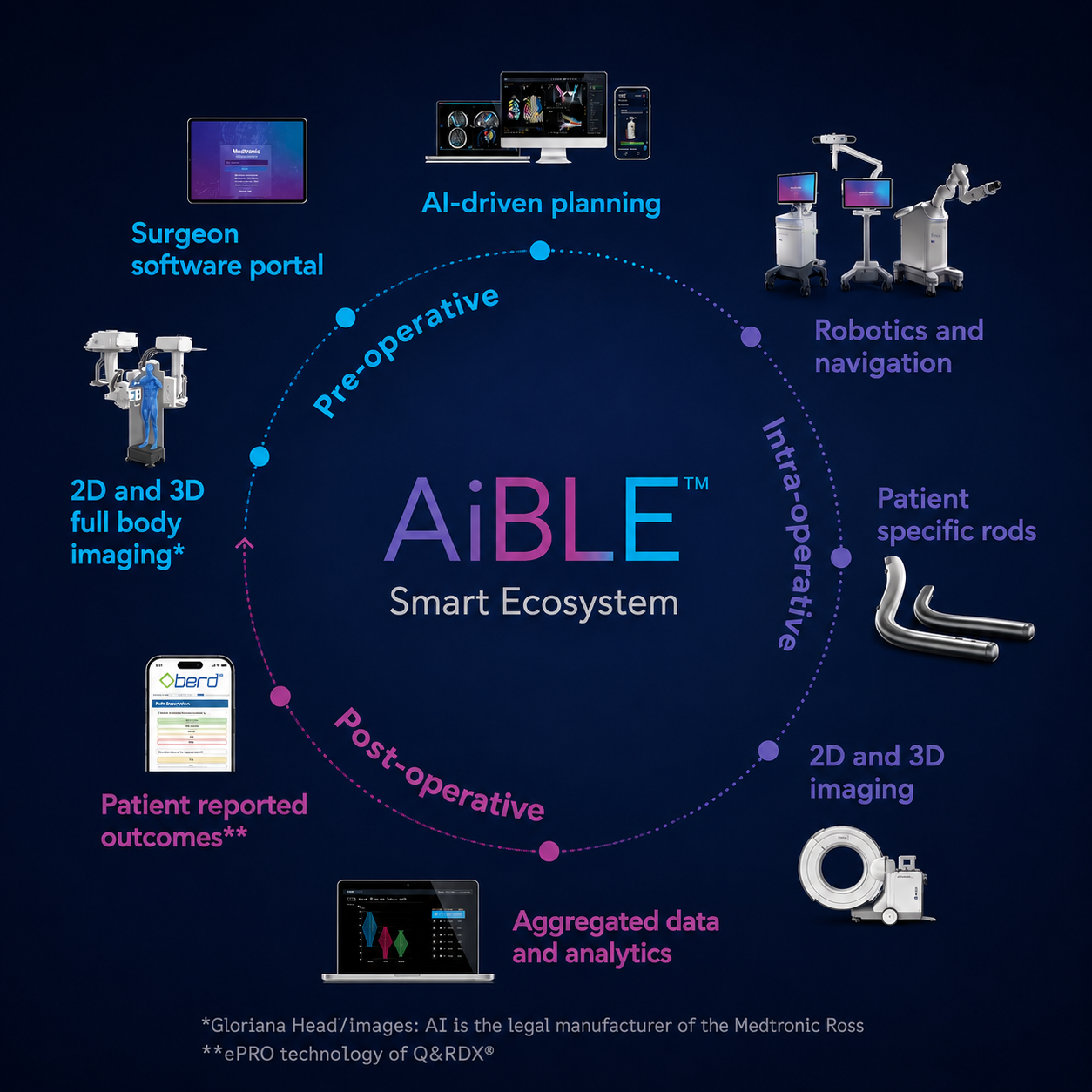 O-arm Robotic Navigation