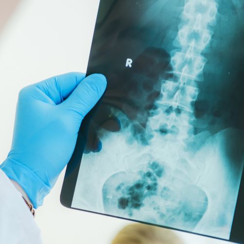 Digital X-Ray