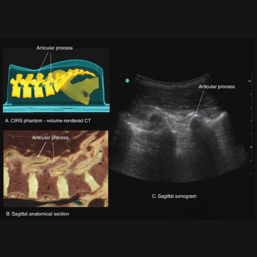 Sonography