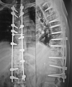 INFECTION CLINIC - Stavya Spine