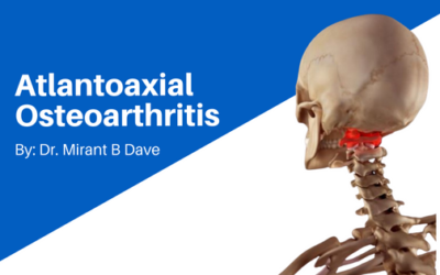 Atlantoaxial Osteoarthritis