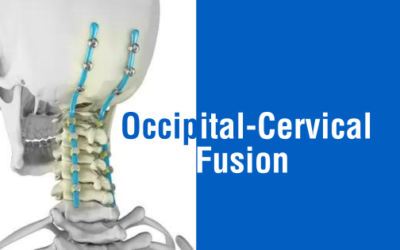 Occipital-Cervical Fusion