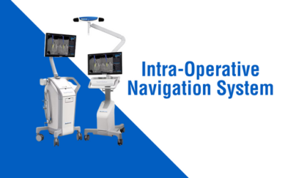 Intra-Operative Navigation System