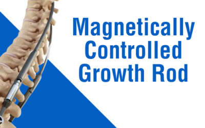 Magnetically Controlled Growth Rod