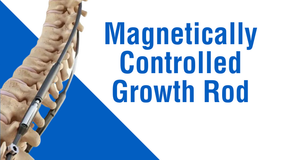 Magnetically Controlled Growth Rod