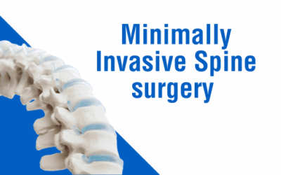Minimally Invasive Spine Surgery (MISS)