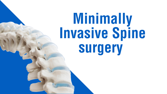Minimally Invasive Spine Surgery (MISS)